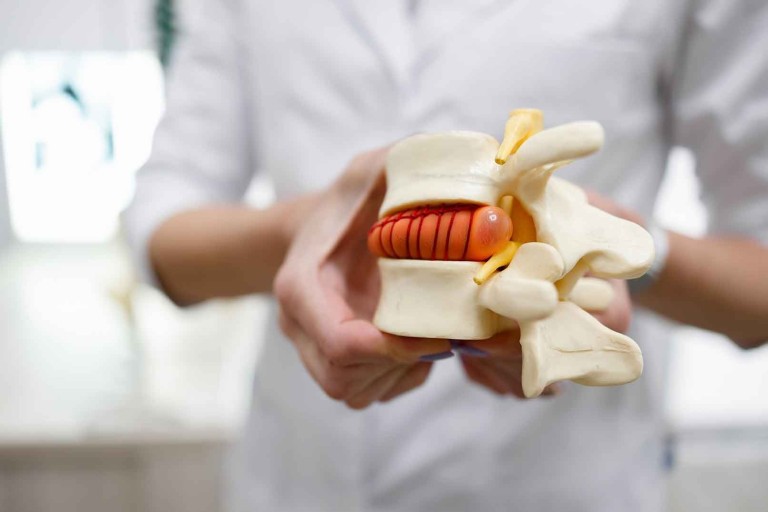 Herniated disk and chiropractic care